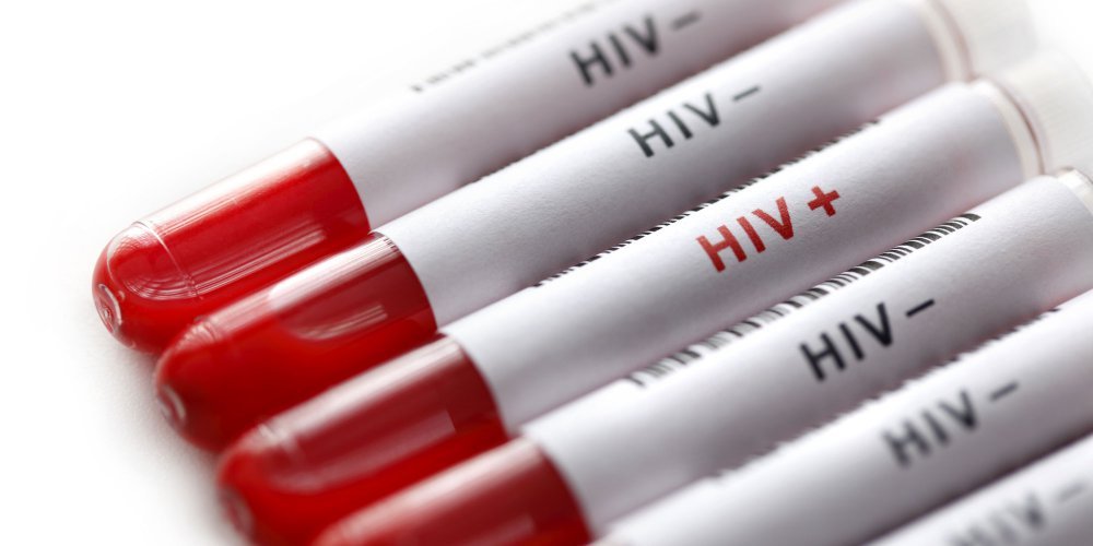 sida-prevention-sidaction